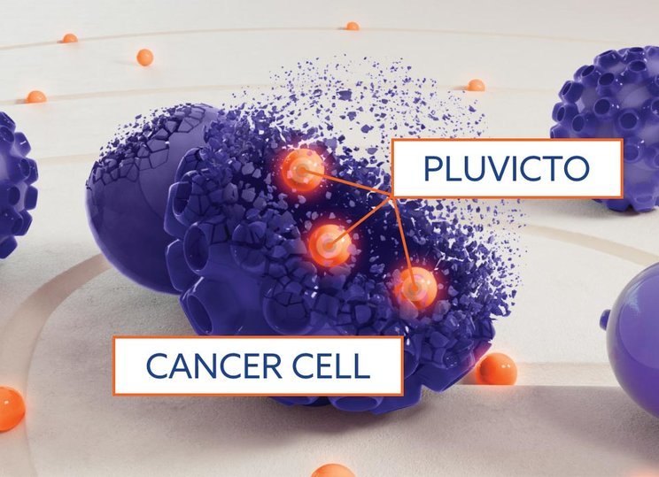 Pluvicto Therapy in Delhi for Advanced Prostate Cancer